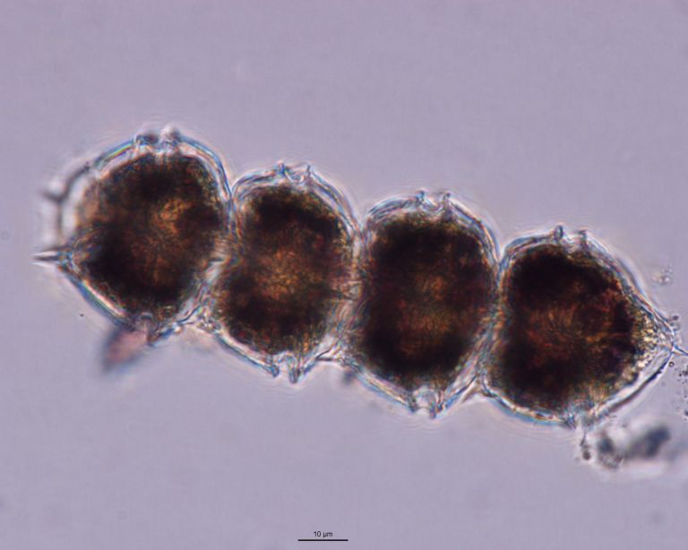 Dictyocha speculum